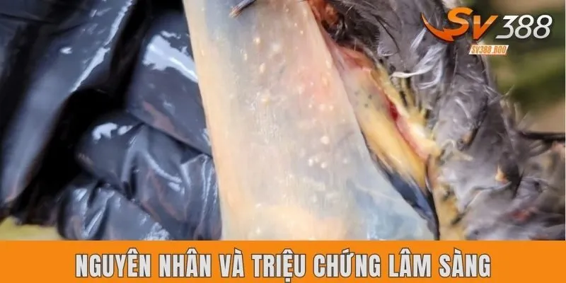 Nguyên nhân và triệu chứng lâm sàng