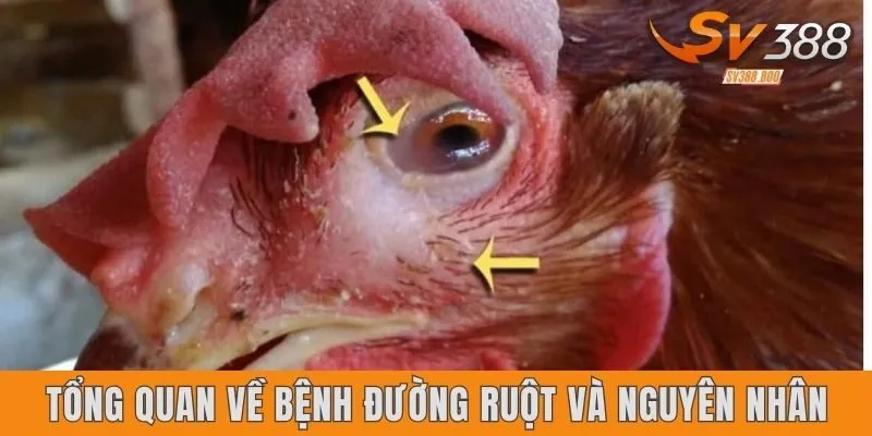 Tổng quan về bệnh đường ruột và nguyên nhân